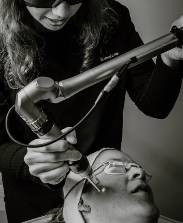 Skin rejuvenation using Laser Genesis
