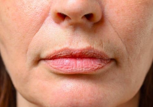 Wrinkle treatment at Dermaluxe Beauty Geelong West