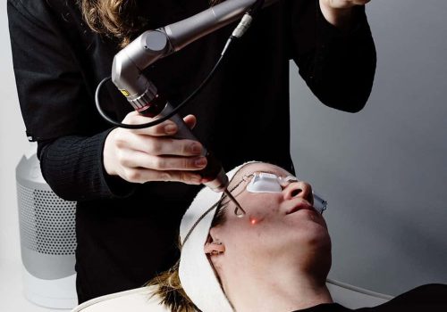 DERMALUXE – SEPTEMBER TEAM + CONTENT Laser therapy for facial skin at Dermaluxe Beauty Geelong