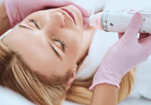 rf micro needling rf micro needling