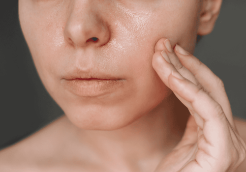 Facial volume restoration consultation at Dermaluxe Beauty