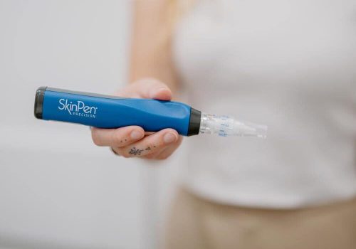 skinPEN SkinPen microneedling treatment at Dermaluxe Beauty Geelong